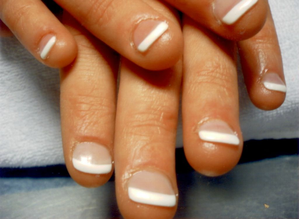 Fingernagel nach der Behandlung